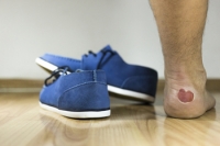 How Blisters on the Feet Can Be Prevented